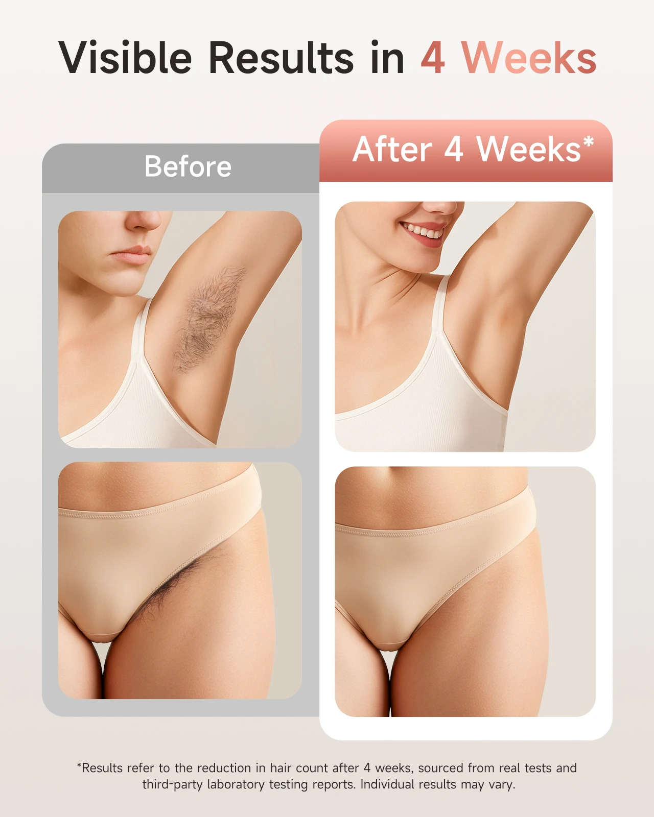 Hair Removal 9 energy levels epiladora laser with Acne treatment for Women’ - Image 4